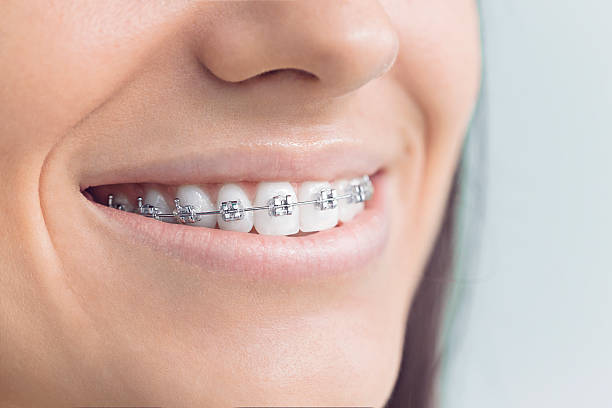 Best Wisdom Tooth Removal  in Syracuse, NY